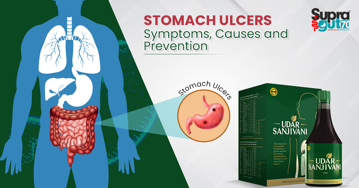 Stomach Ulcers - Symptoms, Causes and Prevention